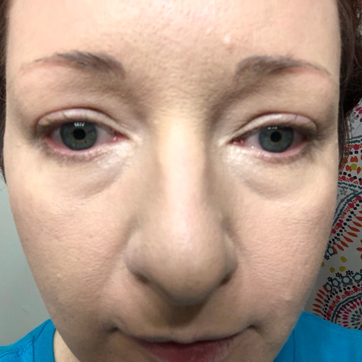 Wrinkles & War Paint, under eye, dark circles, concealer, how to, over 40, eye bags, color corrector